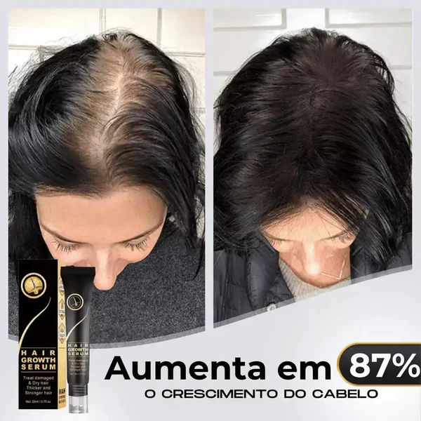 Tratamento Capilar Repair Hair